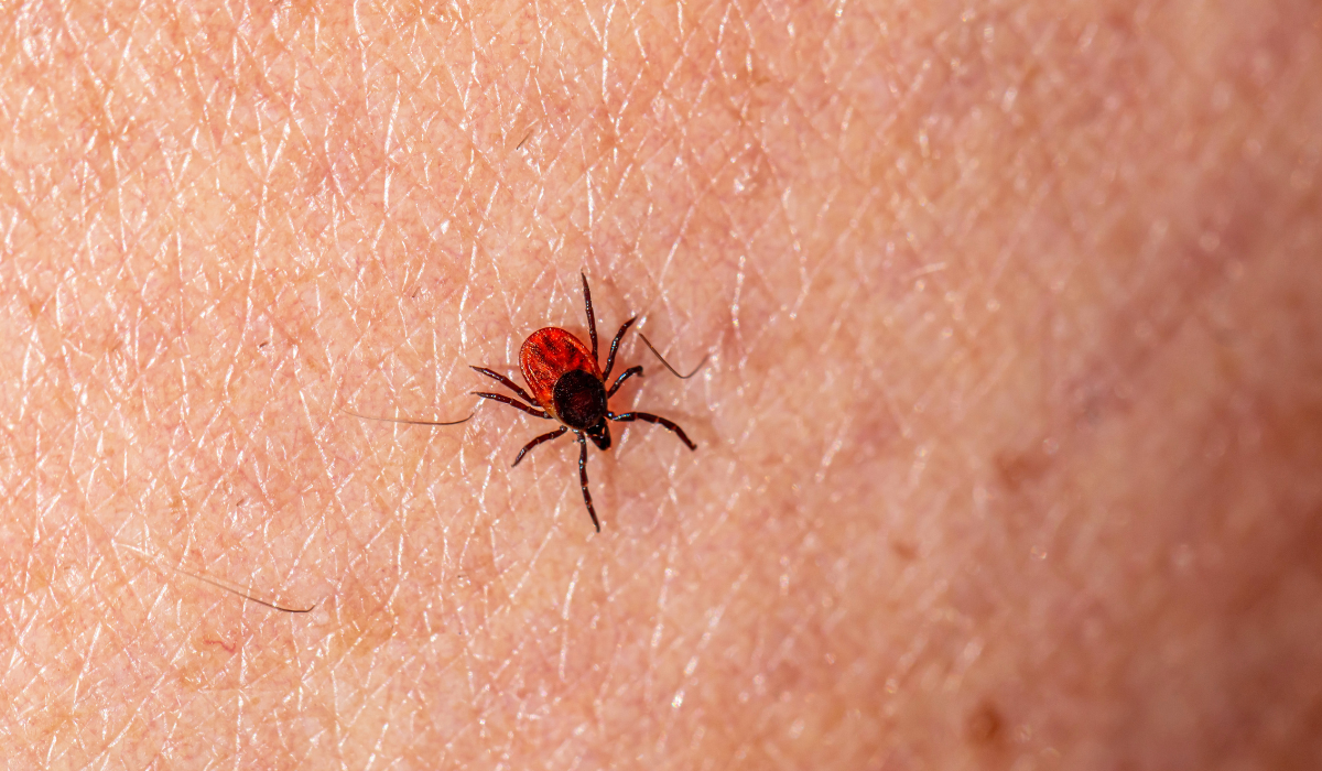 Enfermedad de Lyme, consejos para prevenirla